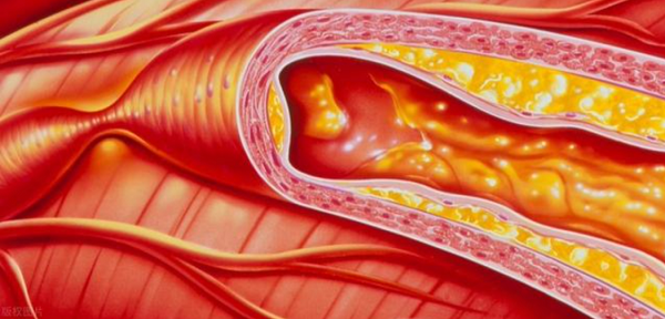 康欣口服液:为心脑血管健康筑牢防线